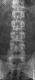 L�ndrygg frontal